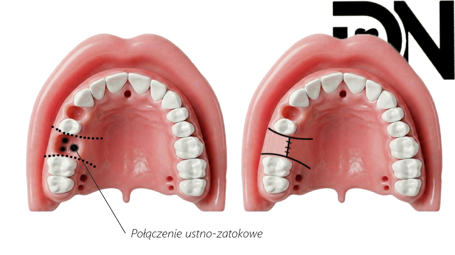 Metoda Zangego