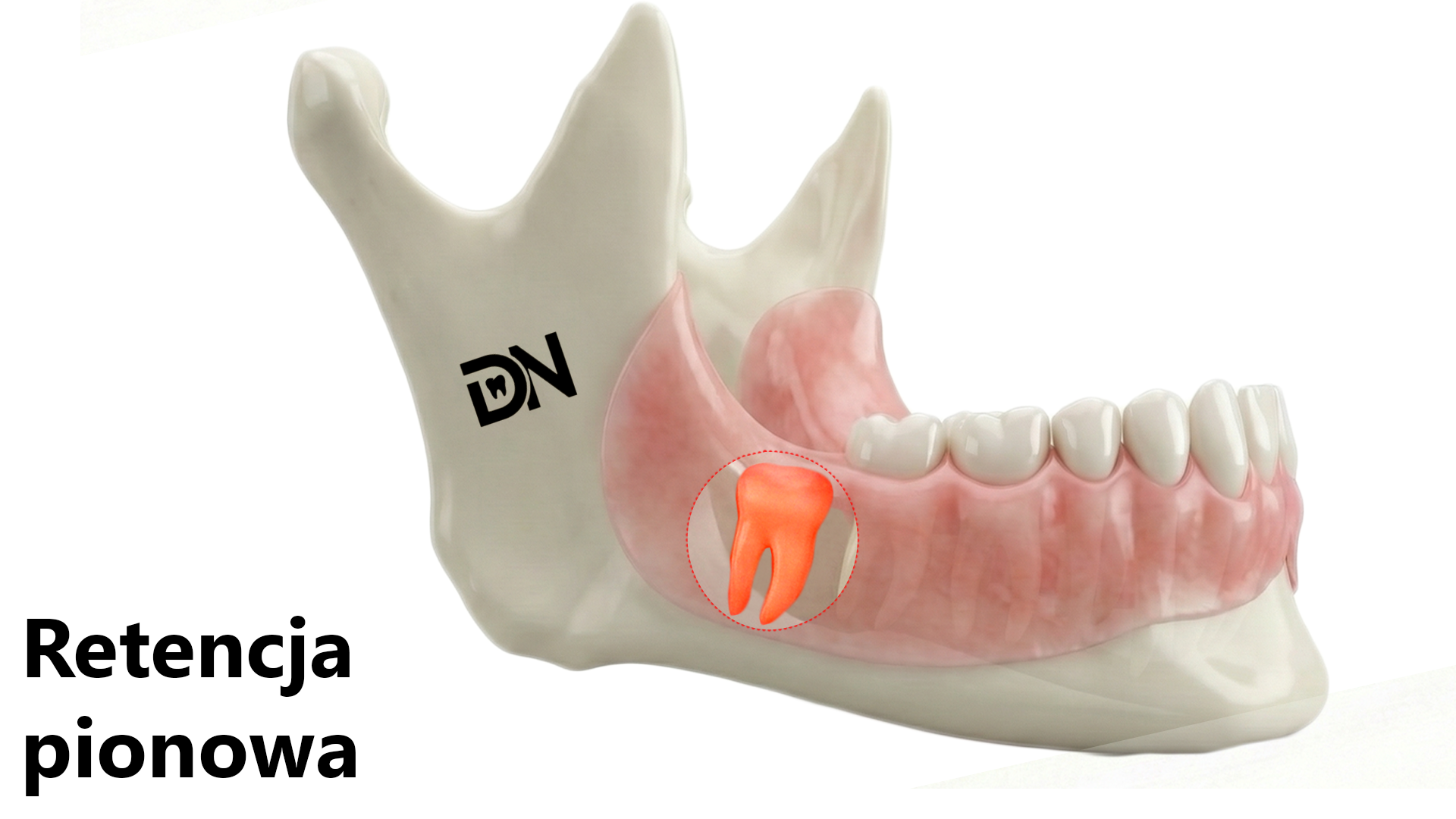 Pionowa(W)