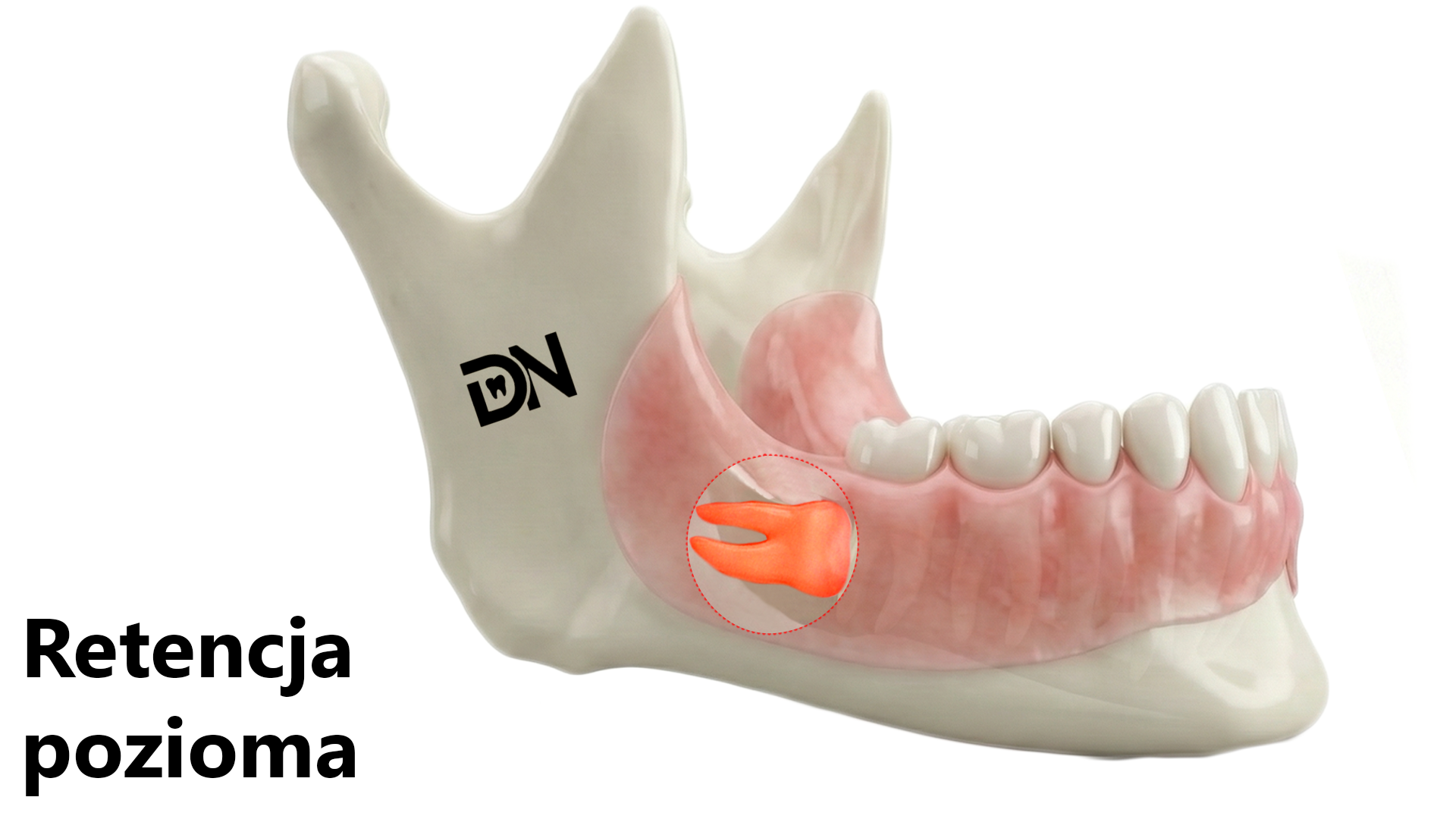 Pozioma(W)