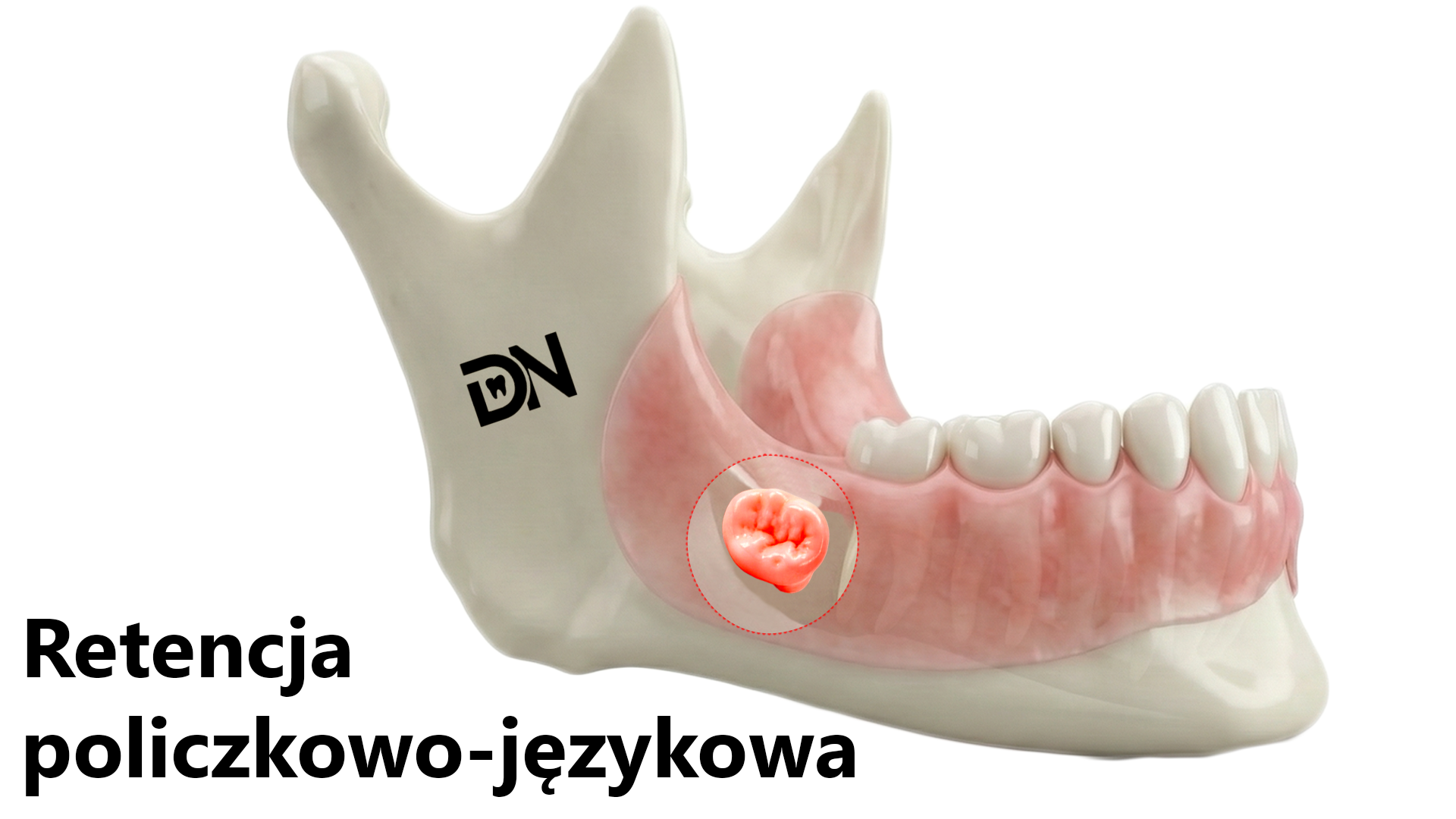 Policzkowo-językowa(W)