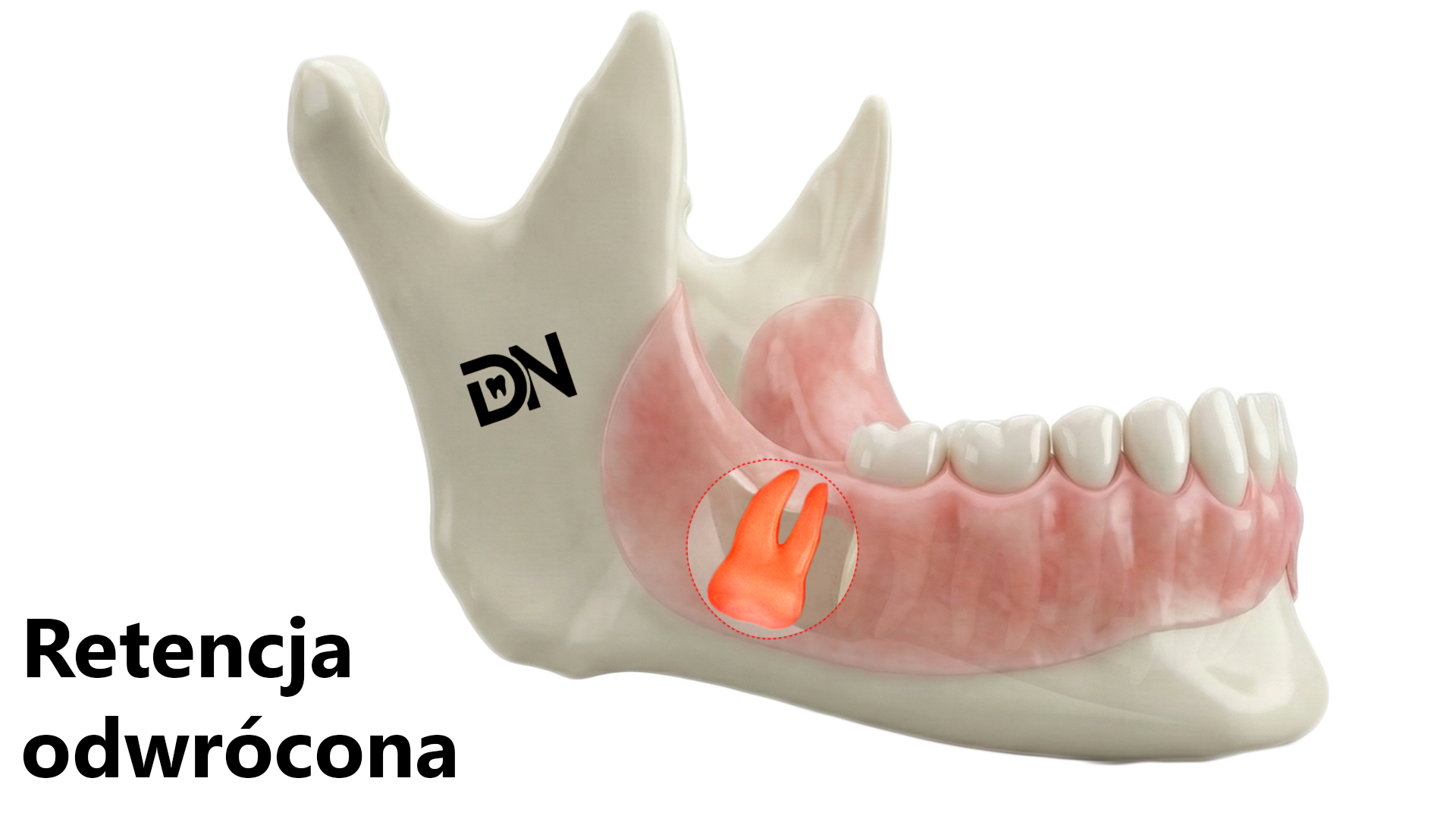 Odwrócona(W)