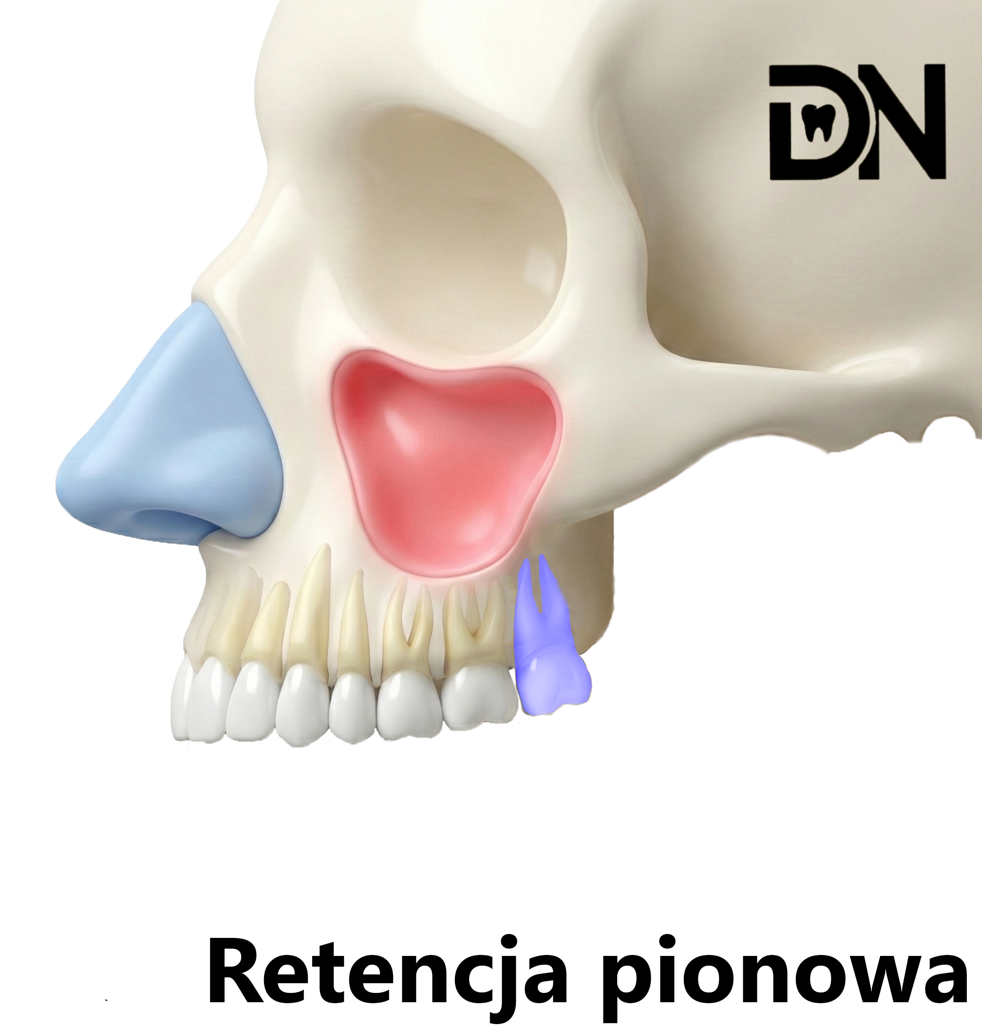 Pionowa(A)