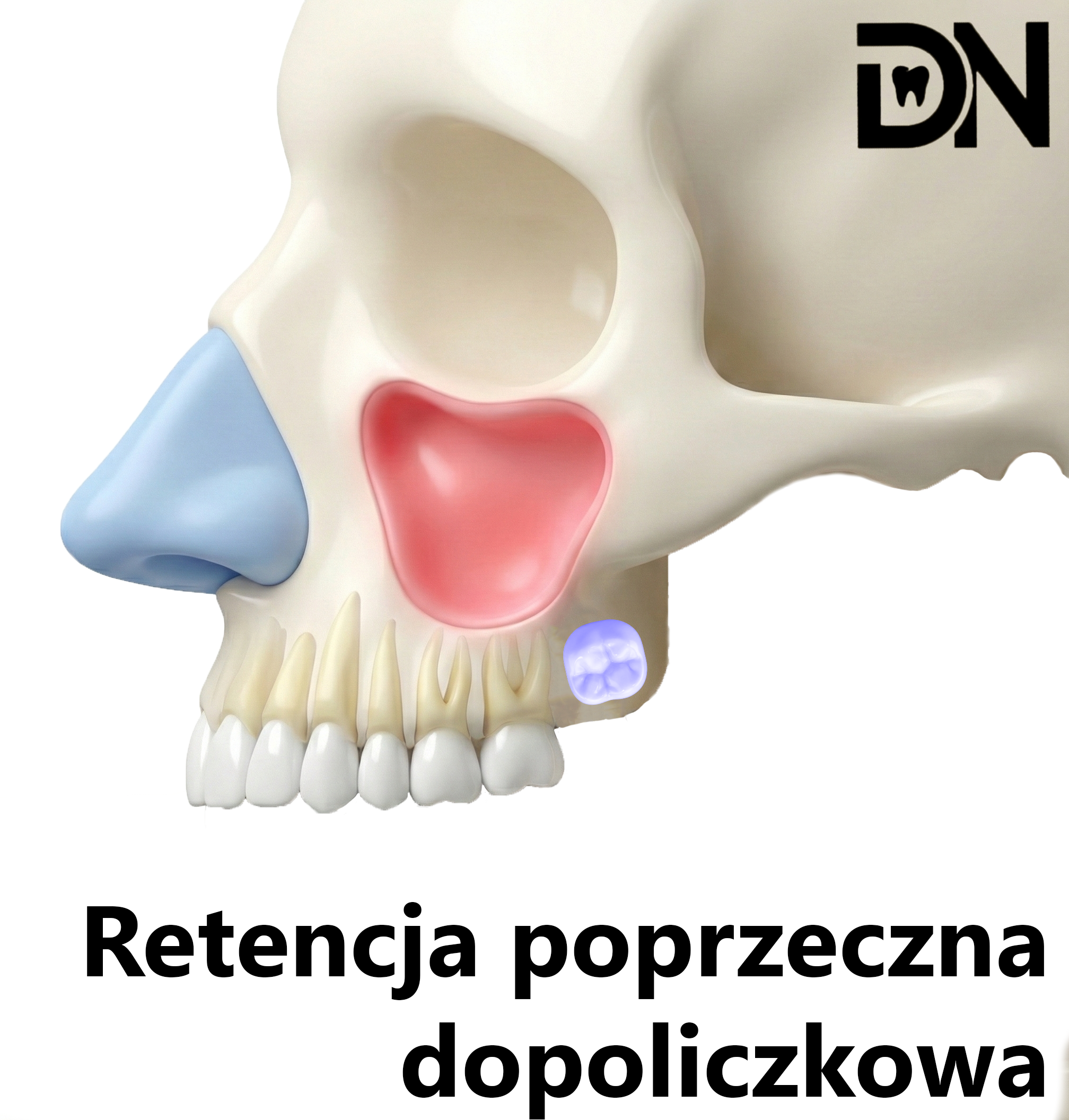 Poprzeczna dopoliczkowa(A)
