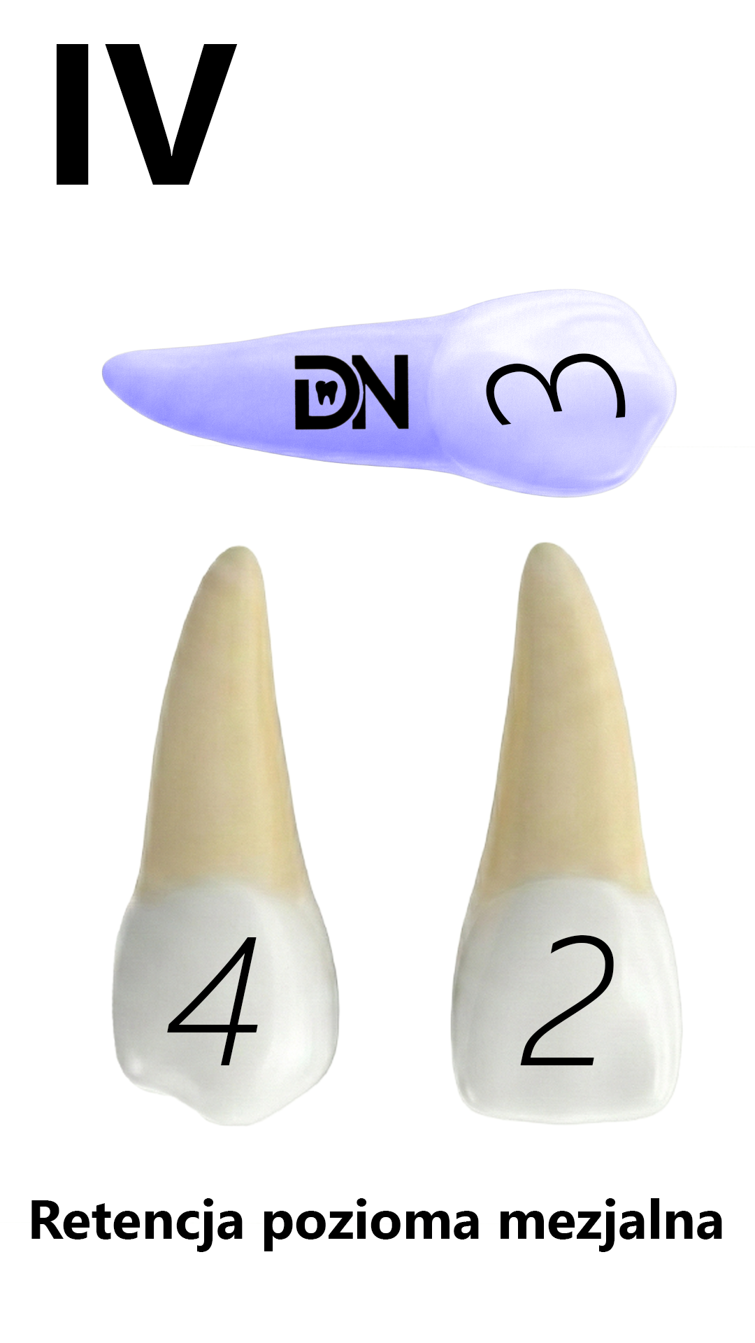 IV