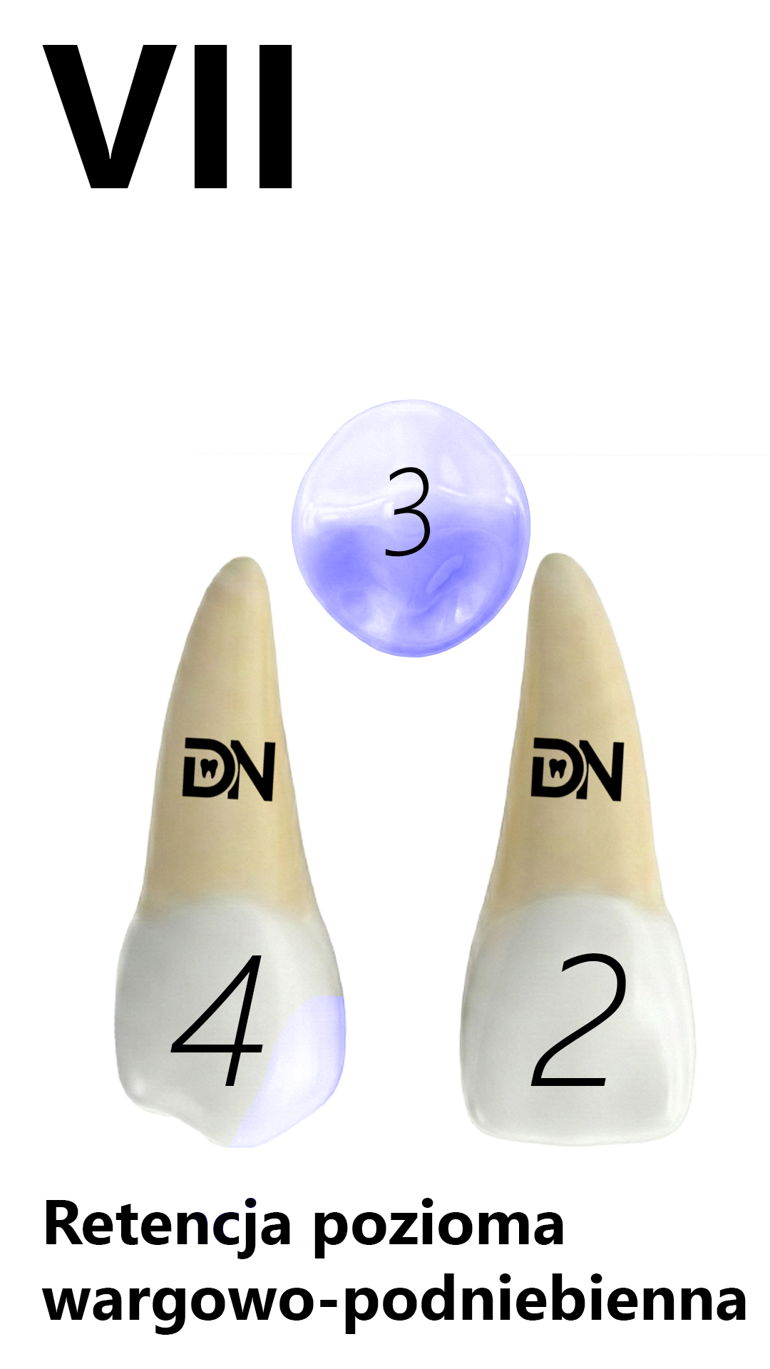 VII